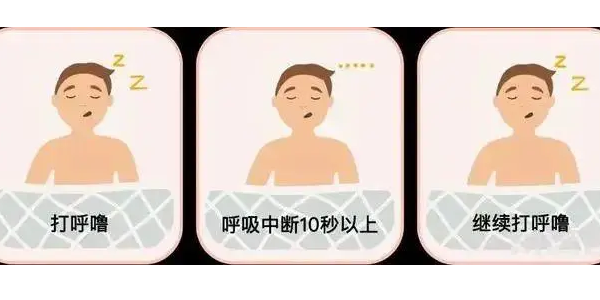 你真的了解睡眠呼吸暫停嗎？6600萬中重度患者正在受害！—仟龍醫(yī)療