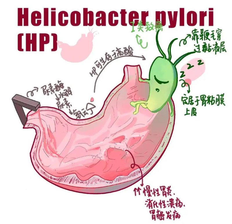 幽門螺旋桿菌